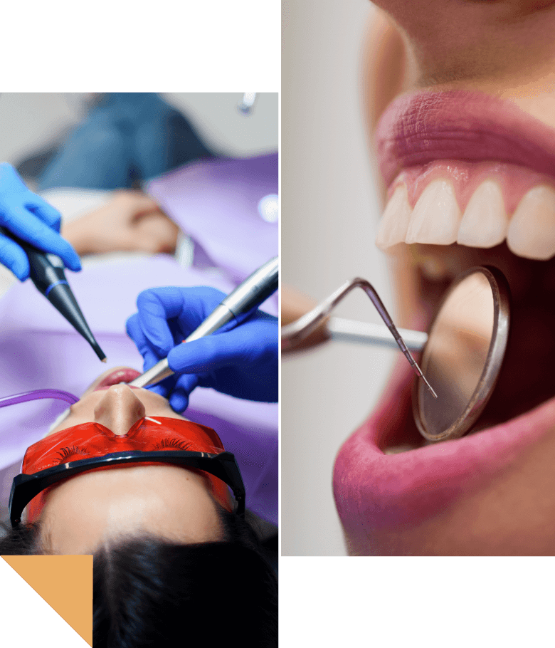 Representation of patients receiving advanced, minimally invasive laser treatment from a dentist at Sam Dent Merivale Dentistry in Ottawa