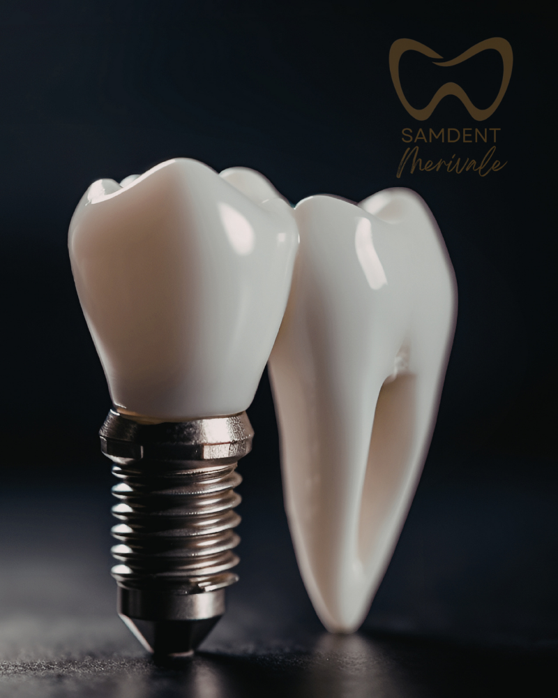 Samdent Dental Implants. Laser Dentistry.